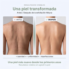 Toalla de ducha exfoliante antibacteriana Nidyva