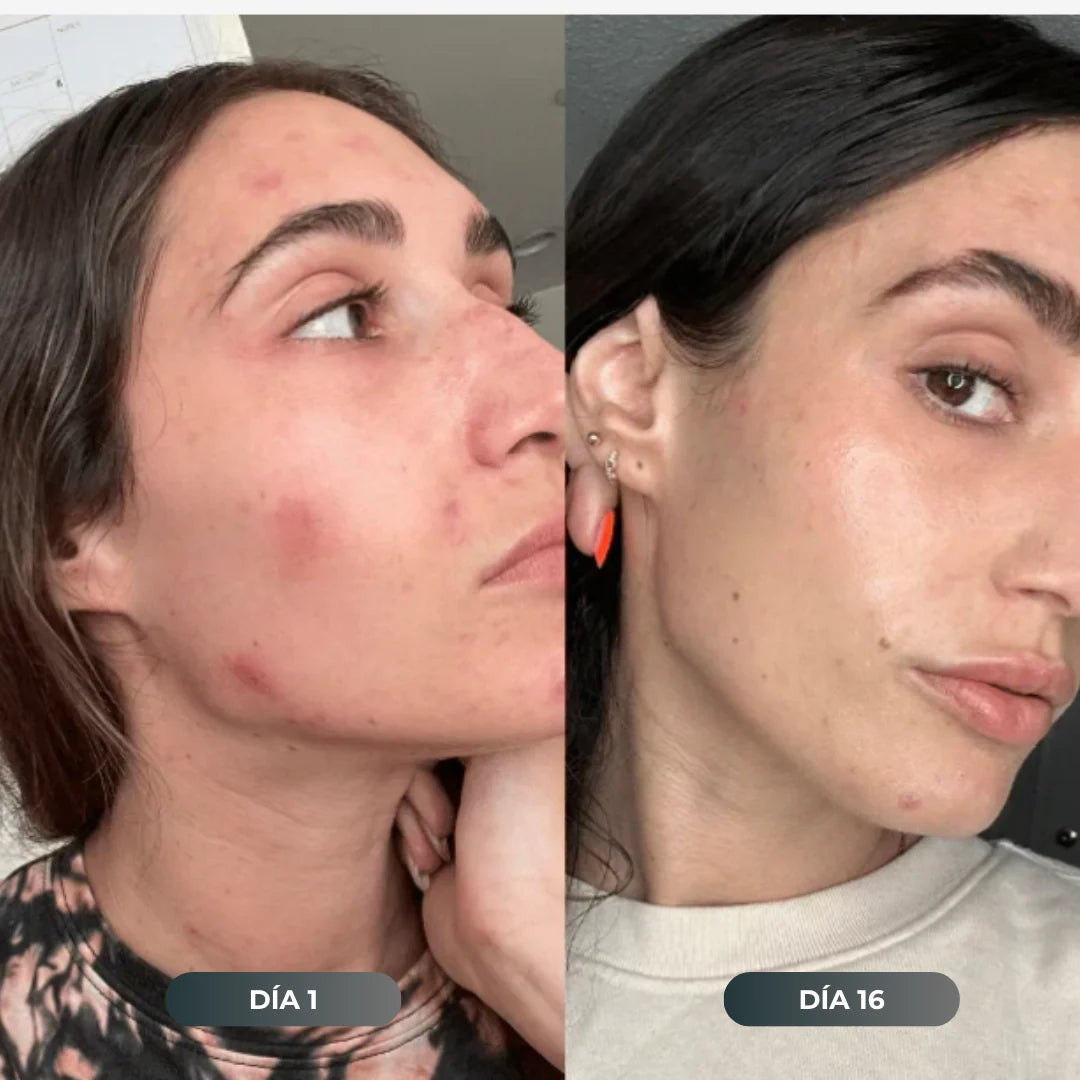 Antes y después
